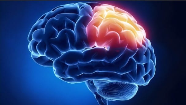 Recuperação de AVC Pode Estar nos Genes